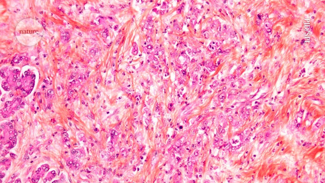 New drugs take aim at one of cancer’s deadliest mutations - Nature